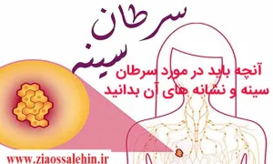 علائم سرطان سینه