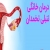 درمان خانگی تنبلی تخمدان